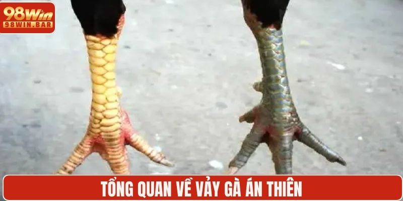 Tổng quan về vảy gà án thiên
